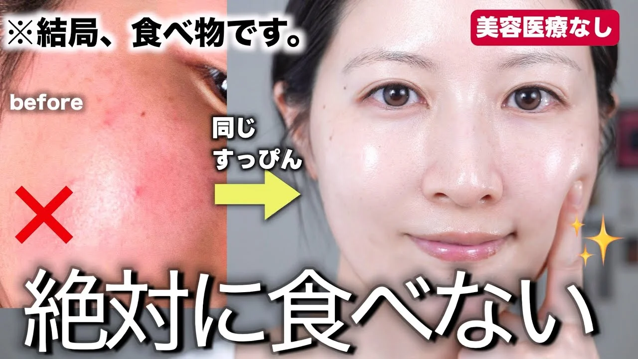 【肌に悪い食品】肌荒れ激減。美肌の人が絶対に避ける食品8選