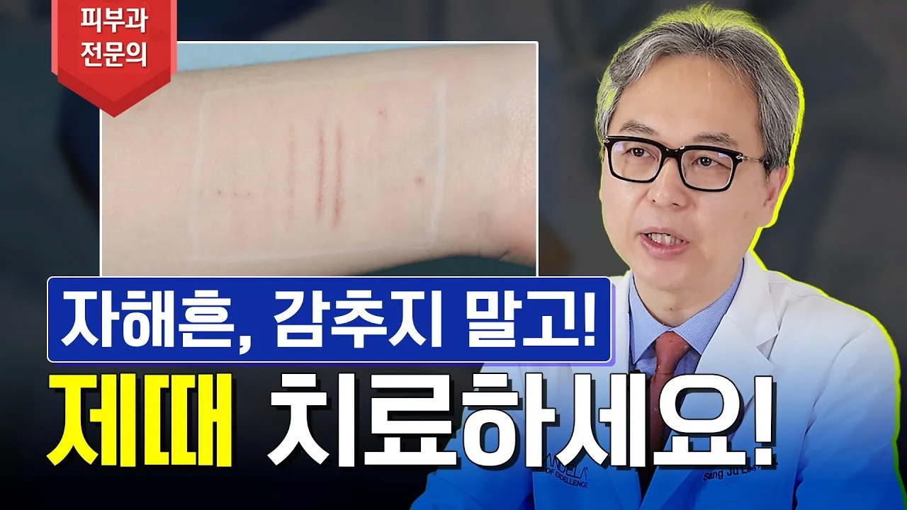 자해 흉터 치료의 골든 타임과 방법