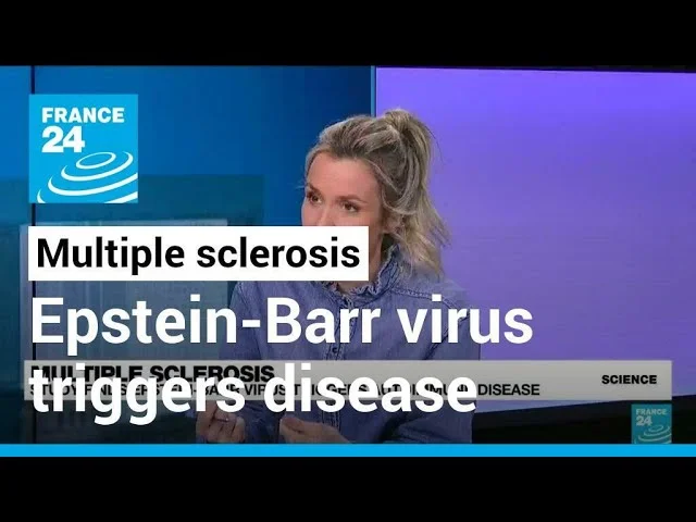 Study Links Epstein-Barr Virus to Multiple Sclerosis Risk