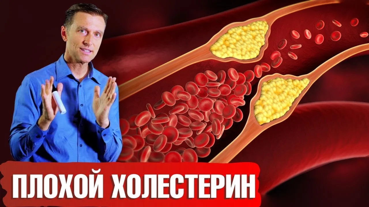 Debunking Myths About LDL Cholesterol